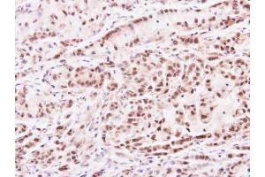 IHC-P Image Immunohistochemical analysis of paraffin-embedded A549 xenograft, using PRMT2, antibody at 1:100 dilution. (PRMT2 antibody)