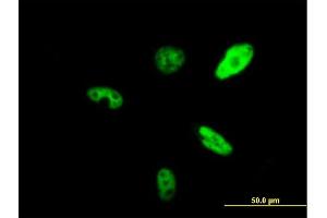 Immunofluorescence of purified MaxPab antibody to SMARCAD1 on HeLa cell. (SMARCAD1 antibody  (AA 1-1028))