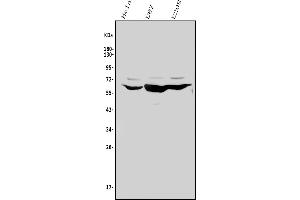 Western blot analysis of Glypican 5/GPC5 using anti-Glypican 5/GPC5 antibody (ABIN7601084).