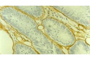 Image no. 1 for anti-Collagen, Type IV (COL4) antibody (ABIN335405) (Collagen IV antibody)