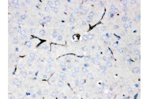 Immunohistochemistry (IHC) image for anti-Ceruloplasmin (Ferroxidase) (CP) (AA 20-258) antibody (ABIN3044508)