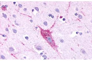 Anti-GPR61 antibody  ABIN1048847 IHC staining of human brain, neurons and glia. (GPR61 antibody  (C-Term))