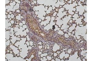 Immunohistochemistry (IHC) image for anti-Cathepsin D (CTSD) (C-Term) antibody (ABIN6254162)