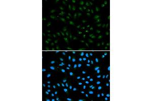 Immunofluorescence (IF) image for anti-Androgen Receptor (AR) antibody (ABIN1871059)