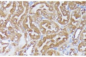 Immunohistochemistry of paraffin-embedded Mouse kidney using DLAT Polyclonal Antibody at dilution of 1:100 (40x lens). (DLAT antibody)
