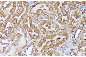 Immunohistochemistry of paraffin-embedded Mouse kidney using DLAT Polyclonal Antibody at dilution of 1:100 (40x lens).