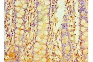 Immunohistochemistry of paraffin-embedded human colon tissue using ABIN7163238 at dilution of 1:100 (PIGX antibody  (AA 42-230))