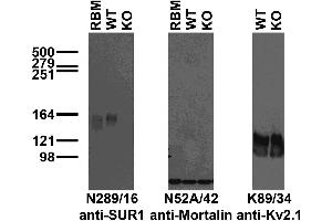 Immunoblot versus crude brain membrane preparations from rat (RBM), SUR1 wild-type (WT) and knockout (KO) mice and probed with N289/16 (left), N52A/42 (center) and K89/34 (right) TC supe.