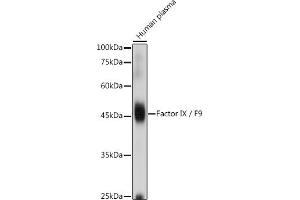 Western blot analysis of extracts of Human plasma, using Factor IX / F9 antibody (ABIN3022173, ABIN3022174, ABIN3022175, ABIN1512886 and ABIN6218646) at 1:1000 dilution. (Coagulation Factor IX antibody  (AA 29-192))