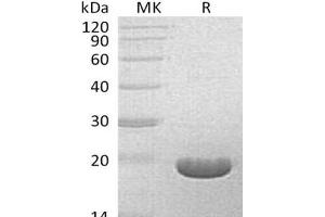 Western Blotting (WB) image for Bifunctional Apoptosis Regulator (BFAR) protein (ABIN7321012) (BFAR Protein)