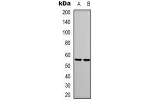 Western blot analysis of RUNX1 expression in Jurkat (A), THP1 (B) whole cell lysates. (RUNX1 antibody)