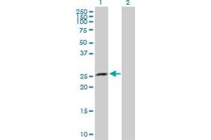 Western Blot analysis of XRCC6BP1 expression in transfected 293T cell line by XRCC6BP1 MaxPab polyclonal antibody. (XRCC6BP1 antibody  (AA 1-246))