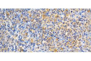 Immunohistochemistry of paraffin-embedded Rat spleen using PRKCE Polyclonal Antibody at dilution of 1:200 (40x lens). (PKC epsilon antibody)