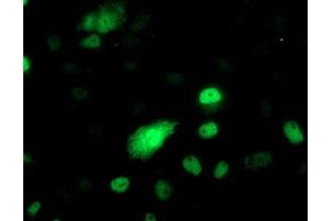 Anti-PHF21B mouse monoclonal antibody (ABIN2454829) immunofluorescent staining of COS7 cells transiently transfected by pCMV6-ENTRY PHF21B (RC204284). (PHF21B antibody)