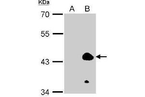 WB Image Sample (100ug of whole cell lysate) A: 293T (mock) B: 293T transfected KLF1 antibody diluted at 1:2000 (KLF1 antibody  (N-Term))