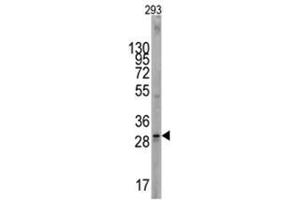 Image no. 1 for anti-KIT Ligand (KITLG) (C-Term) antibody (ABIN357009) (KIT Ligand antibody  (C-Term))