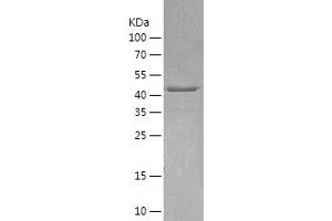 Western Blotting (WB) image for Arrestin, beta 1 (ARRB1) (AA 1-418) protein (His tag) (ABIN7121897) (beta Arrestin 1 Protein (AA 1-418) (His tag))