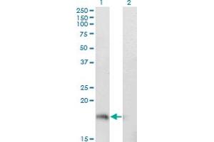 Western Blot analysis of STMN1 expression in transfected 293T cell line by STMN1 monoclonal antibody (M01A), clone 3A9. (Stathmin 1 antibody  (AA 40-149))