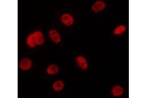 ABIN6275687 staining Hela by IF/ICC. (ZC3H13 antibody  (C-Term))