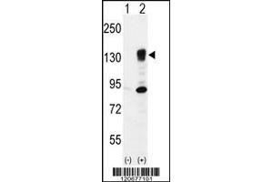 Western blot analysis of ITGA5 using rabbit polyclonal ITGA5 Antibody using 293 cell lysates (2 ug/lane) either nontransfected (Lane 1) or transiently transfected (Lane 2) with the ITGA5 gene.