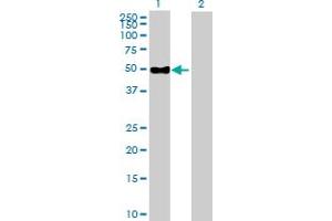 Western Blot analysis of ENPP6 expression in transfected 293T cell line by ENPP6 MaxPab polyclonal antibody. (ENPP6 antibody  (AA 1-440))