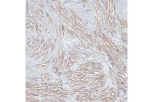 Immunohistochemistry of paraffin-embedded human uterus using Tropomyosin 1 antibody (ABIN3021577, ABIN3021578, ABIN3021579, ABIN1513635 and ABIN6215262) at dilution of 1:100 (40x lens). (Tropomyosin antibody  (AA 1-245))