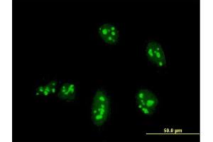 Immunofluorescence of monoclonal antibody to NANOG on HeLa cell. (Nanog antibody  (AA 98-195))
