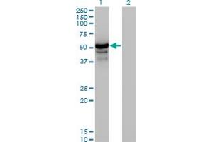 Western Blot analysis of HERPUD1 expression in transfected 293T cell line by HERPUD1 monoclonal antibody (M04), clone 2G7.