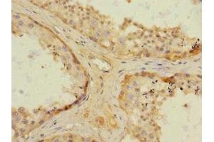 Immunohistochemistry of paraffin-embedded human testis tissue using ABIN7161916 at dilution of 1:100 (NRBP1 antibody  (AA 406-535))