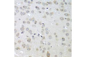 Immunohistochemistry of paraffin-embedded mouse brain using ACHE antibody (ABIN5974721) at dilution of 1/100 (40x lens). (Acetylcholinesterase antibody)