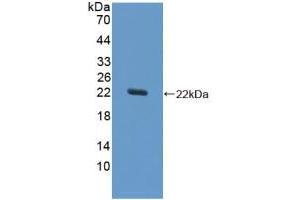 Western blot analysis of recombinant Horse SOD1. (SOD1 antibody  (AA 2-154))