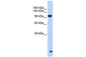 Image no. 1 for anti-Trinucleotide Repeat Containing 6B (TNRC6B) (AA 180-229) antibody (ABIN6740661) (TNRC6B antibody  (AA 180-229))