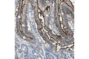 Immunohistochemical staining (Formalin-fixed paraffin-embedded sections) of human duodenum with SLC2A5 polyclonal antibody  shows strong membranous positivity in glandular cells.