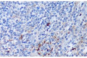 Immunohistochemistry of paraffin-embedded Human tonsil using PADI4 Polyclonal Antibody at dilution of 1:100 (40x lens). (PAD4 antibody)