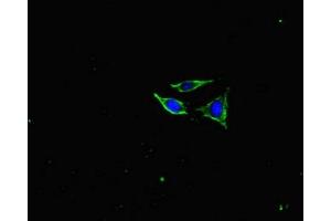 Immunofluorescent analysis of SH-SY5Y cells using ABIN7161278 at dilution of 1:100 and Alexa Fluor 488-congugated AffiniPure Goat Anti-Rabbit IgG(H+L) (NEFL antibody  (AA 128-271))