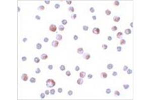 Immunocytochemistry of TCTN3 in HeLa cells with TCTN3 antibody at 4 μg/ml. (TCTN3 antibody  (C-Term))