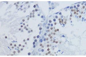 Immunohistochemistry of paraffin-embedded Rat testis using TriMethyl-Histone H3-K36 Polyclonal Antibody at dilution of 1:200 (40x lens).