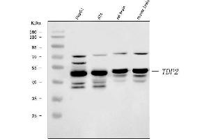 Western blot analysis of TDP2 using anti-TDP2 antibody (ABIN7600905). (TDP2 antibody  (AA 25-332))