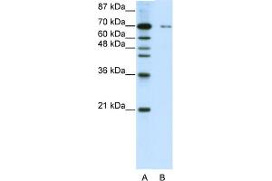 WB Suggested Anti-ZNF398 Antibody Titration:  0. (ZNF398 antibody  (C-Term))