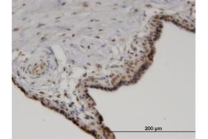 Immunoperoxidase of monoclonal antibody to PPM1A on formalin-fixed paraffin-embedded human placenta. (PPM1A antibody  (AA 1-382))