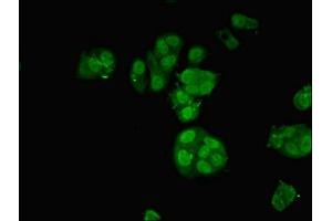 Immunofluorescent analysis of MCF-7 cells using ABIN7161860 at dilution of 1:100 and Alexa Fluor 488-congugated AffiniPure Goat Anti-Rabbit IgG(H+L) (NCOA4 antibody  (AA 1-280))