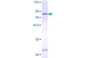 LEFTY1 Protein (AA 1-366) (GST tag)