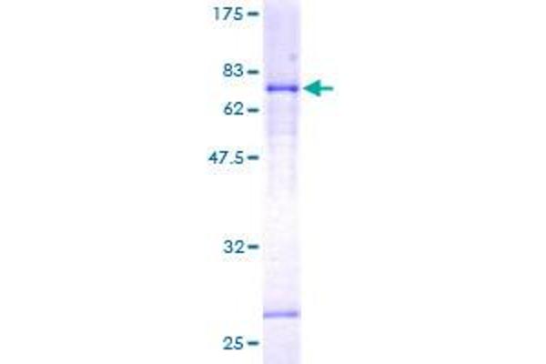 LEFTY1 Protein (AA 1-366) (GST tag)