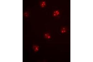 Immunofluorescent analysis of MCM6 staining in Hela cells. (MCM6 antibody)