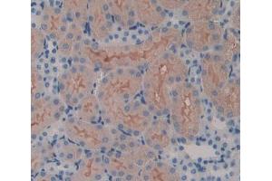 #VALUE! (SPTLC3 antibody  (AA 80-563))