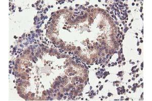 Image no. 12 for anti-COBW Domain Containing 1 (CBWD1) antibody (ABIN1497117) (CBWD1 antibody)