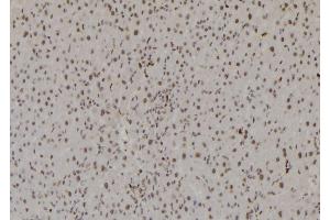 ABIN6277200 at 1/100 staining Rat liver tissue by IHC-P. (Histone 3 antibody  (H3K27me3))