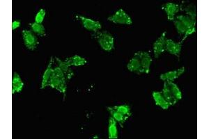 Immunofluorescent analysis of HepG2 cells using ABIN7153390 at dilution of 1:100 and Alexa Fluor 488-congugated AffiniPure Goat Anti-Rabbit IgG(H+L) (Cyclin D2 antibody  (AA 215-285))