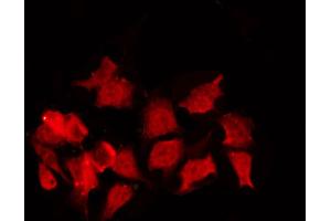 ABIN6267380 staining NIH-3T3 by IF/ICC. (Cyclin B1 antibody  (pSer147))