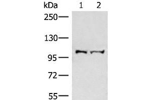Western blot analysis of Mouse brain tissue and Jurkat cell lysates using EFTUD2 Polyclonal Antibody at dilution of 1:550 (EFTUD2 antibody)